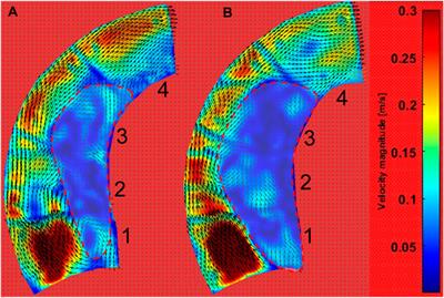 The effect of terminal impedance on aortic morphology and hemodynamics: an in vitro phantom study using flow field visualization